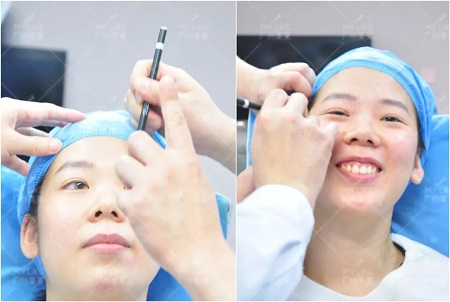 超值勁爆 | 玻尿酸，僅需？80！