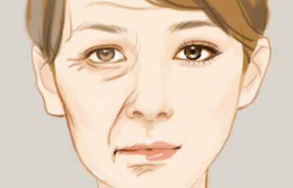 重慶注射祛魚尾紋的價格是多少？