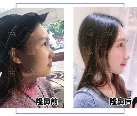 從萬(wàn)人嫌到萬(wàn)人迷，只悄悄變了這個(gè)部位？