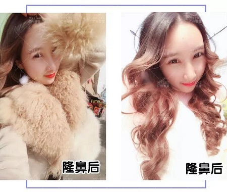 從萬(wàn)人嫌到萬(wàn)人迷