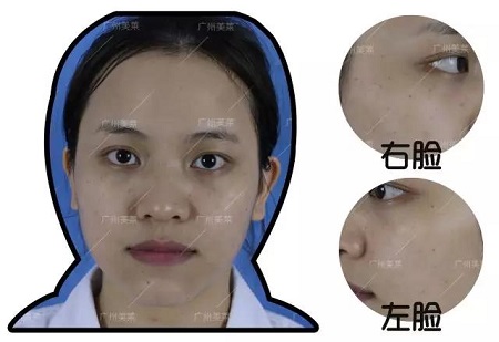 一旦長(zhǎng)了斑，再好的顏也只能做路人...