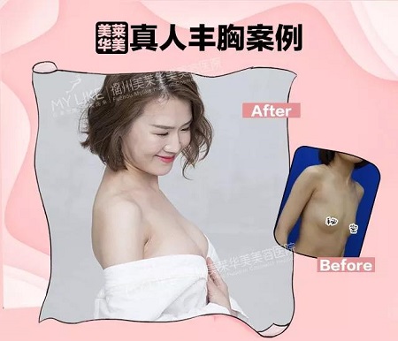 “從小喝到大”的椰汁能豐胸？那我剛隆的胸面子往哪放