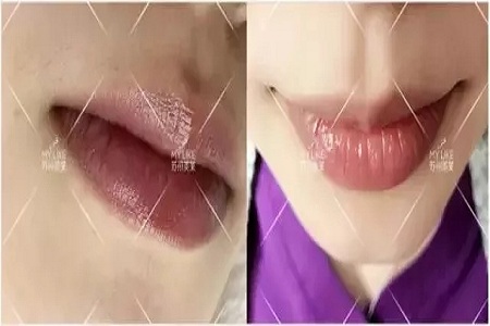 想過(guò)嗎？為啥有人的體毛多有的人少？