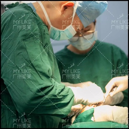 隆鼻后10天，從塌鼻素人變高冷女神！