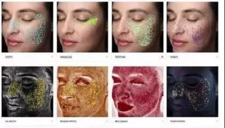 注意！祛斑方法不對，臉上的色斑會越來越深！