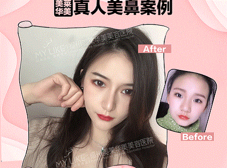 她曾丑到無(wú)人問津，現(xiàn)在卻擁有魔鬼身材，簡(jiǎn)直是“行走的美人魚”