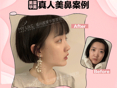 現(xiàn)在卻擁有魔鬼身材，簡(jiǎn)直是“行走的美人魚”