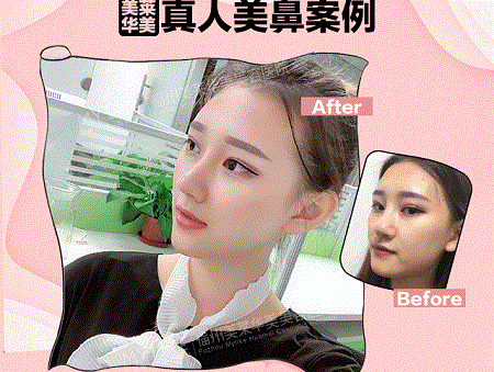 現(xiàn)在卻擁有魔鬼身材，簡(jiǎn)直是“行走的美人魚”