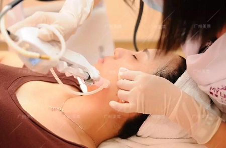 避雷指南丨如何選擇適合自己的玻尿酸產品？