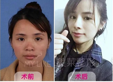 長著一張“大媽臉”的她，卻比喬妹還能收割男神？！