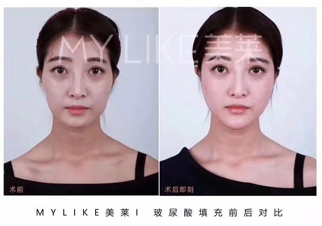 卻比喬妹還能收割男神？！