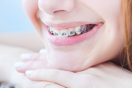 長沙口腔<a href='/' target='_blank'><u>整形醫(yī)院</u></a>哪家好