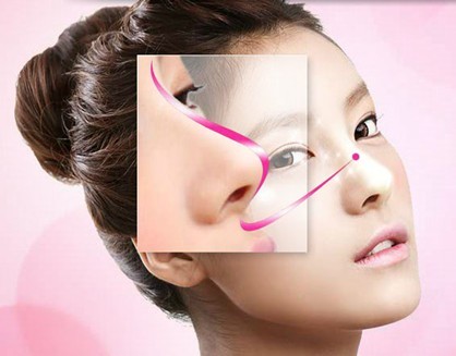 武漢鼻翼縮小術(shù)價格需要多少？