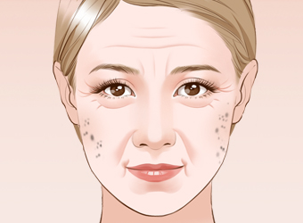 重慶做激光祛斑一次大概多少錢？