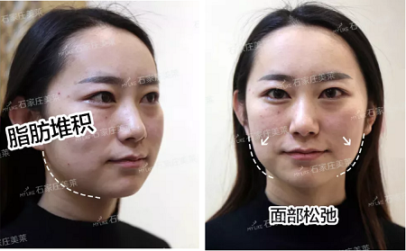 素顏邋遢老態(tài)，被嘲貴圈“照騙”！