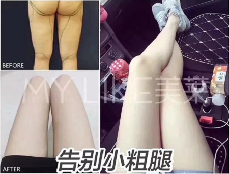 簡(jiǎn)單幾招瘦小肚子，火速收藏！