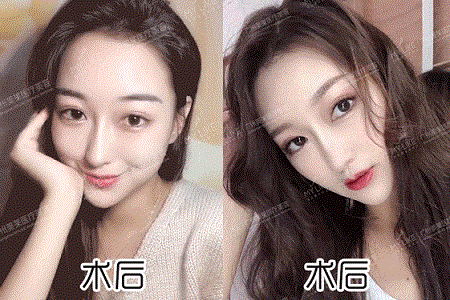 鼻子1個部位整得好，能拯救全臉！