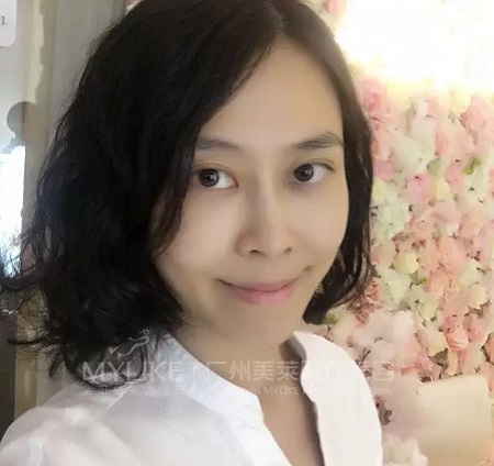 10分鐘打玻尿酸，即刻效果驚人！