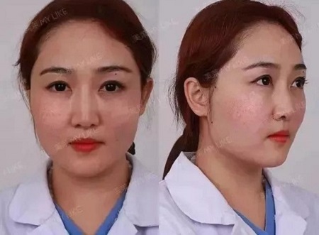 全日本女生較想整容的范本竟是她？！