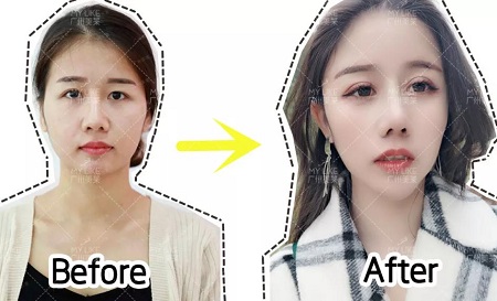 換對(duì)鼻子宛如換了一張臉，大媽臉秒變神仙顏！