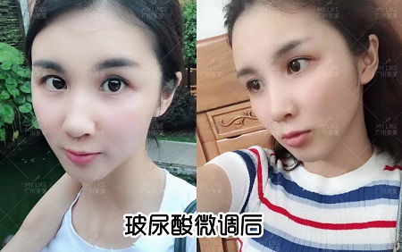 阿姨臉化身顏值擔(dān)當(dāng)，微調(diào)效果到底有多美？