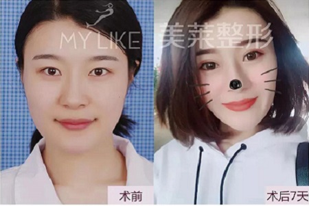 有圖有真相！每一個(gè)單眼皮的妹子都是潛力股~