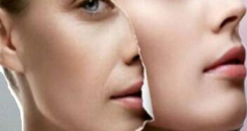 激光美白多少錢(qián)一次