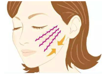 廈門*雕提升術(shù)的費用大概是多少