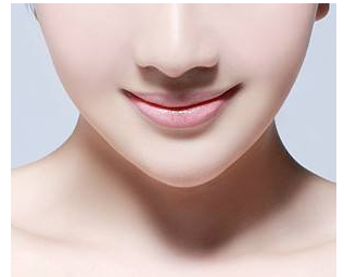鄭州做假體墊下巴術(shù)后要注意什么呢？