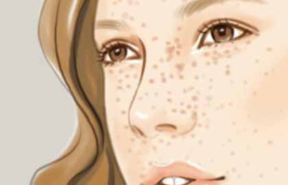 <a href='/gz/' target='_blank'><u>廣州美萊</u></a>醫(yī)療美容醫(yī)院祛斑效果好嗎？