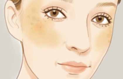 廣州美萊醫(yī)療美容醫(yī)院祛斑效果好嗎？
