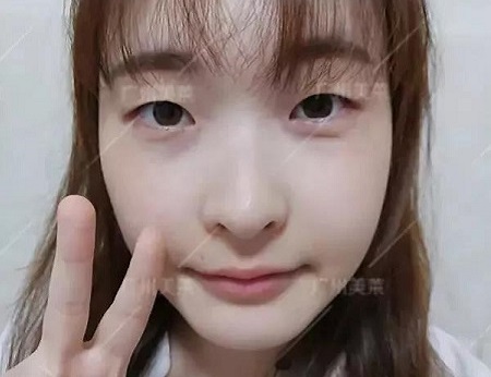 祛斑較全科普，頑固斑、反黑斑有救啦！