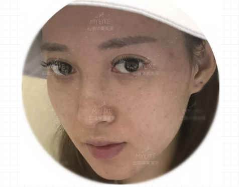 一言不合就爛臉，直到我遇到了舒敏之星！