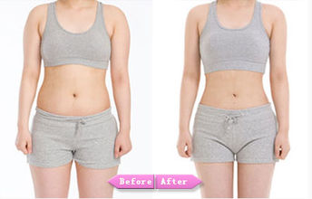 南京腰部吸脂價格是多少？