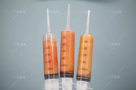 脂肪填充20天，美到讓人舔屏！