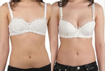 廣州脂肪隆胸要多少錢？
