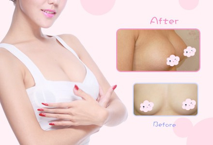 天津內(nèi)窺鏡隆胸多少錢？