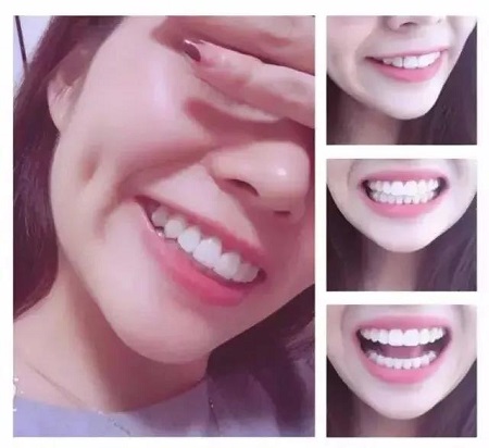 美萊特邀口腔醫(yī)師徐寶華，3月10日親診<a href='/sjz/' target='_blank'><u>石家莊美萊</u></a>。