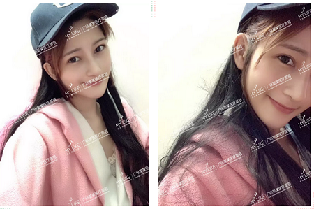 95后廣州女仔，連整2個部位，7天逆襲混血女神！