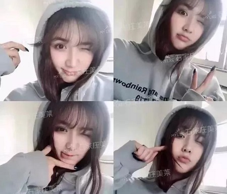 脂肪填充1周后，小喪臉竟嫩過少女！