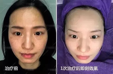 你不長(zhǎng)斑誰(shuí)長(zhǎng)斑！