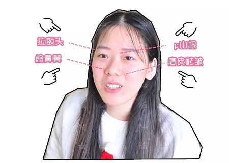 “奶茶妹妹”親姐花24萬(wàn)整容