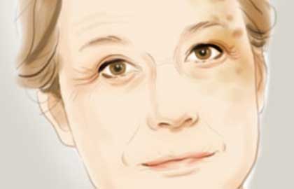 深圳美容祛斑整容醫(yī)院靠譜么？