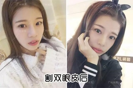 唱跳俱佳的她，割雙眼皮后都可以出道了！