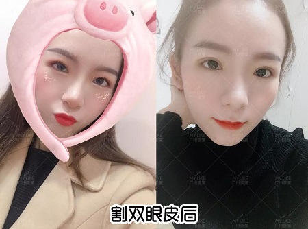 遭萬人唾棄的死魚眼，變身后竟美得不像話！