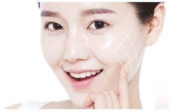 面部埋線需要手術(shù)嗎？