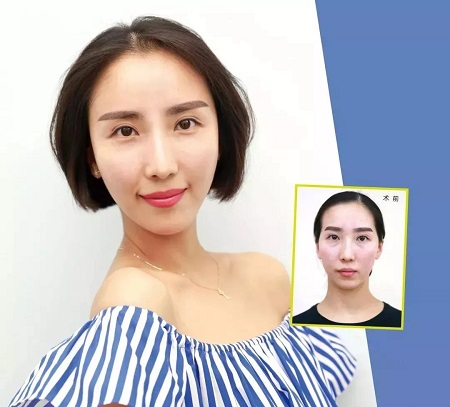 斗魚一姐換頭才大火，而她打個玻尿酸就成網(wǎng)紅了...