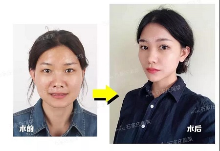 她們的眼睛做的，男神都會(huì)多看幾眼！