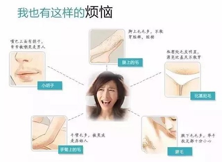 脫毛年卡38元起 |脫掉尷尬,秀出迷人好身材！