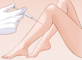 瘦腿的價(jià)格？